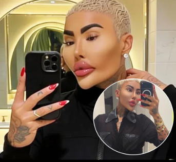Influencer Jordan James Found Dead After Suspected Cosmetic Procedure as Police Probe Incident