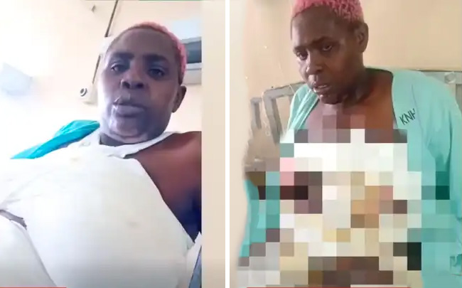 Woman Admitted at KNH After Being Burned With Hot Maragwe Soup Over “Tutam” Remark Woman Admitted at KNH After Being Burned With Hot Maragwe Soup Over “Tutam” Remark